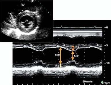 Left ventricle: Size Internal linear dimensions M-mode measurements guided by targeted SAX or PLAX view