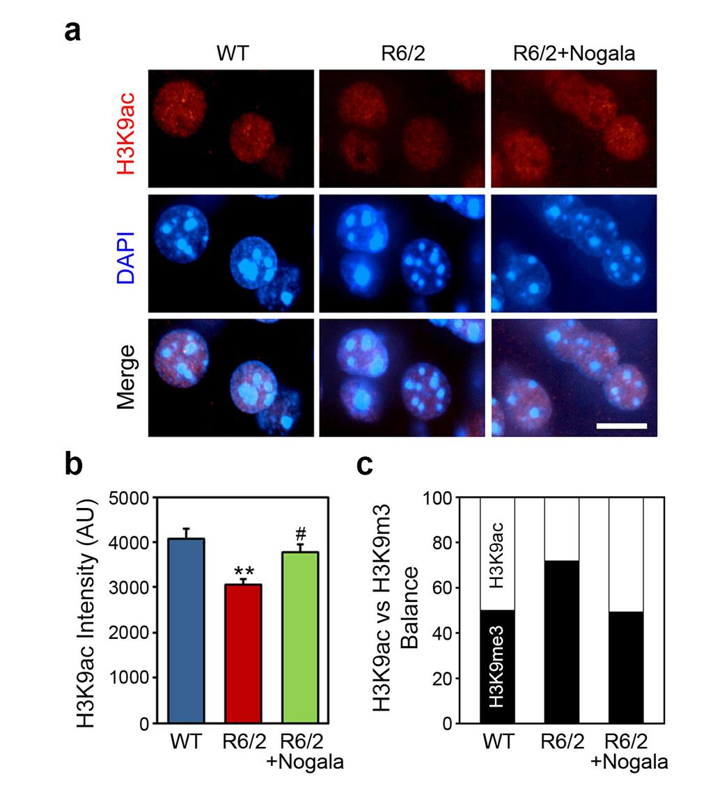 Supplementary Figure 4. Nogalamycin modulates the ratio of H3K9me3 versus acetylated histone H3K9 (H3K9ac) in the striatum of HD transgenic (R6/2) mice.