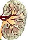 Kidney failure Coronary