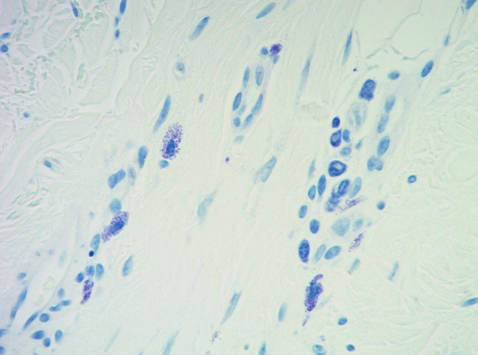 024, lichen planus: P value = 0/036, insect bite/allergic contact dermatitis/nummular dermatitis: P value = 0.009) distribution (see Figure 2). 4.1. Histological Examination 4.1.1. Morphology.