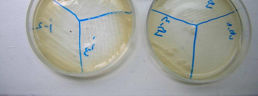 milk after pasteurization or sterilization. Fig. 3 Clostridium pozitive from yogurt and sana Fig.