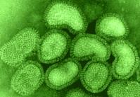 VIRUSES Many diseases of plants and animals are caused by bacteria or viruses that invade the body.