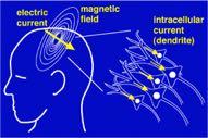 activity by recording magnetic fields produced by electrical