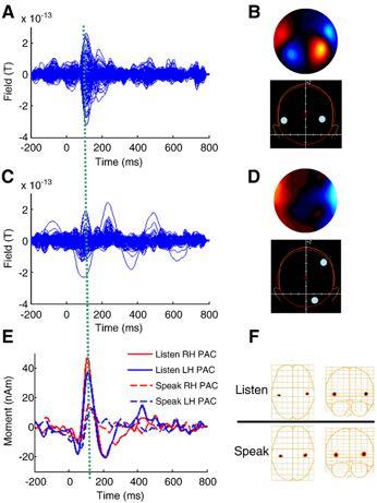 Adults who stutter--listening to a 1 khz tone, produced words