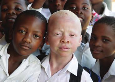 Sample Problem 2: Determining the Mode of Inheritance for an Allele Individuals with albinism have a defect in an enzyme that is involved in the production of melanin, a pigment normally found in the