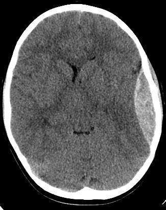 Head/ neck CT examinations at Legevakten : reported by radiologist on call Ullevål Major