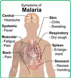 COMPLICATED MALARIA Symptoms Change in behaviour, confusion Impaired consciousness Multiple/recurrent convulsion; Respiratory distress;