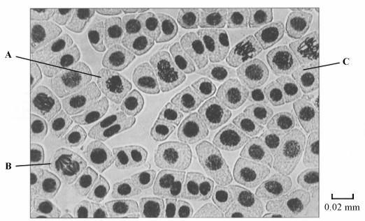 (c) Explain one advantage of cells lining the human gut dividing very frequently....... (Total 6 marks) 14. The photograph shows cells from an onion root tip.