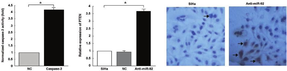 472 A B C D Figure 4. mir 92 was identified to affect the proliferative and invasive activity of SiHa cells and the expression of PTEN.