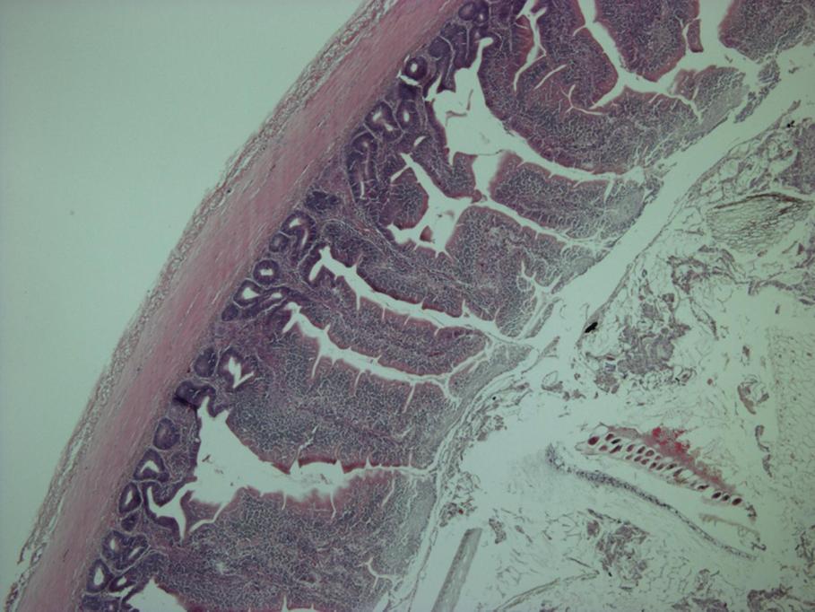 measured Figure 4: Microscopic view of ilial