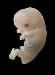 An embryo is: A multicellular undeveloped organism in its beginning