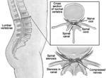 20a Disorders of the Axial Skeleton Abnormal spinal curvatures Scoliosis an