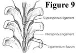 spine to absorb compressive stresses Annulus fibrosis An outer collar of ligaments and fibrocartilage Contains the nucleus pulposus