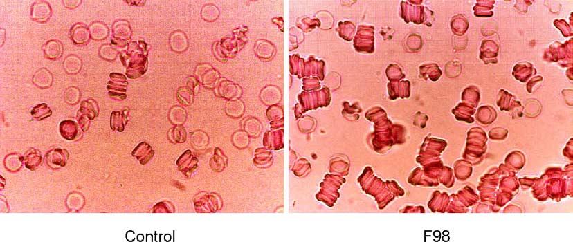 O. Yalcin et al. / Effect of enhanced red blood cell aggregation on blood flow resistance 515 2.6. Statistics The data are presented as mean±standard error.