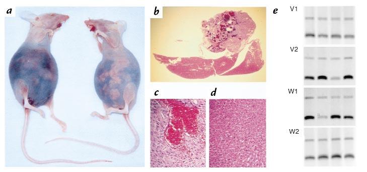 Figure 3 Characteristic of tumor growth in nude mice after intraperitoneal inoculation with 10 4 Ang2-transfected HuH7 HCC cells.