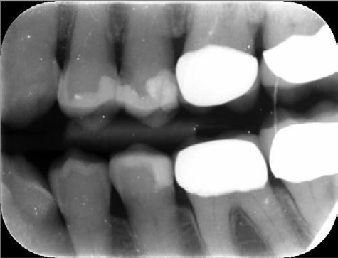 to identify a missing tooth if the center of the image is offset significantly or if a part of the image is very dark due to image quality.