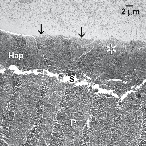 Etched Enamel Structure and Topography: Interface with Materials 13 Fig. 1.9.