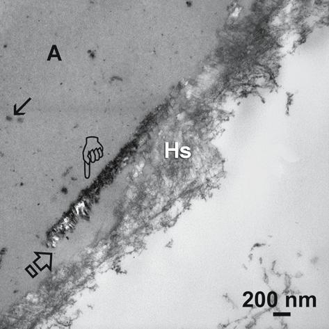 18 F.R. Tay D.H. Pashley Fig. 1.12. Stained, demineralized TEM shows the static application of a mild single-step, filled, self-etch adhesive, One-Up Bond F (Tokuyama) to cut enamel.