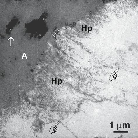 Etched Enamel Structure and Topography: Interface with Materials 19 Fig. 1.13. Stained, demineralized TEM shows the application of One-Up Bond F to phosphoric acid-etched, cut enamel.