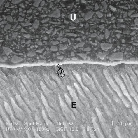20 F.R. Tay D.H. Pashley Fig. 1.14. Field emissionenvironmental SEM (FE-ESEM) image of the application of a selfadhesive resin cement, RelyX Unicem (3 M ESPE), to cut enamel.