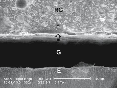 24 F.R. Tay D.H. Pashley Fig. 1.19. Environmental SEM image shows the bonding of a resin-modified GIC (Fuji II LC; GC Corp.) to cut enamel without the use of a dentine conditioner.