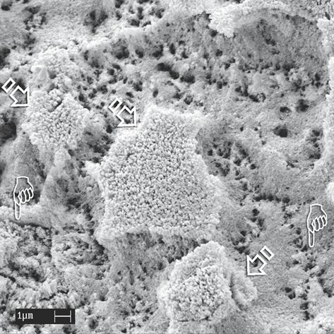 Etched Enamel Structure and Topography: Interface with Materials 11 Fig. 1.6. An SEM image of uncut enamel after static application of 32% phosphoric acid for 15 s.