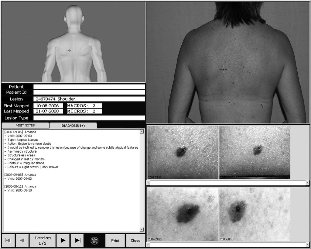should screening for melanoma ever be recommended, it will need to be performed in primary care.