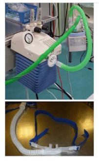 High flow humidified nasal oxygen (HFNOT) It is mostly used in Intensive Care Units, High Dependency Units and other specialised areas Mechanism of action Controlled FiO 2 Pharyngeal dead space