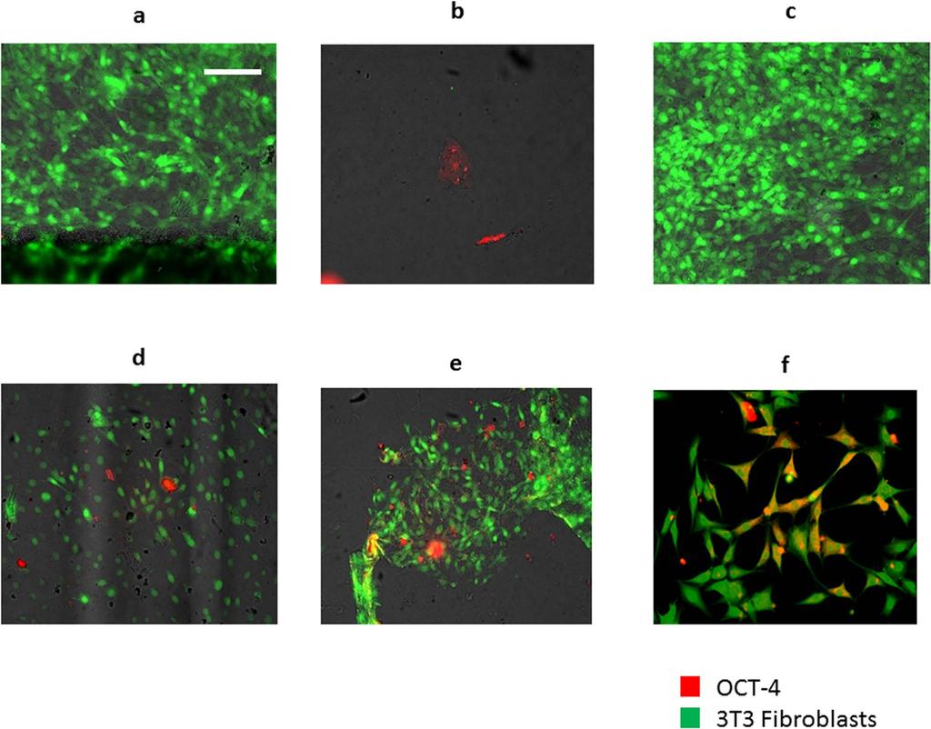 Figure 2. Time course of OCT-4 expression. (a) OCT-4 expression of GFP + fibroblasts cultured for 7 days in normal ph 7.4 media. (b) OCT-4 expression MDA-MB-231 cells, positive control.