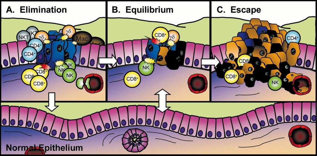CANCER IMMUNOEDITING C-1 Figure 3 The three Es of cancer immunoediting: elimination, equilibrium, and escape.