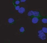 (e) Expression of (green, white arrows) from MSC cells or MSC CXCR6-/- cells were observed following
