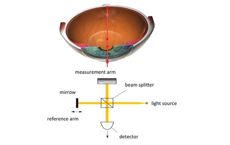 FEATURES OF THE PENTACAM AXL Axial Length Measurement and 3-D Scans in One Routine Exam IOL power calculations (sphere, toric, postrefractive) Scheimpflug imaging Iris imaging, showing sclears blood