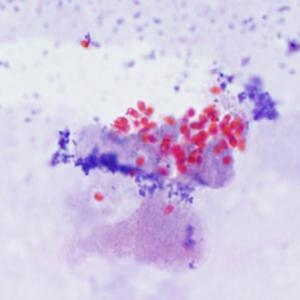 ü trichrome stain It is generally recognized that stained fecal films are the single most productive means of stool examination for intestinal protozoa.