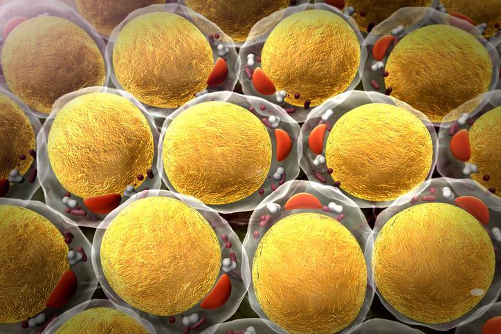 Inflammation Obese individuals often have chronic lowlevel inflammation Fat cells in the body Release specialised immune cells