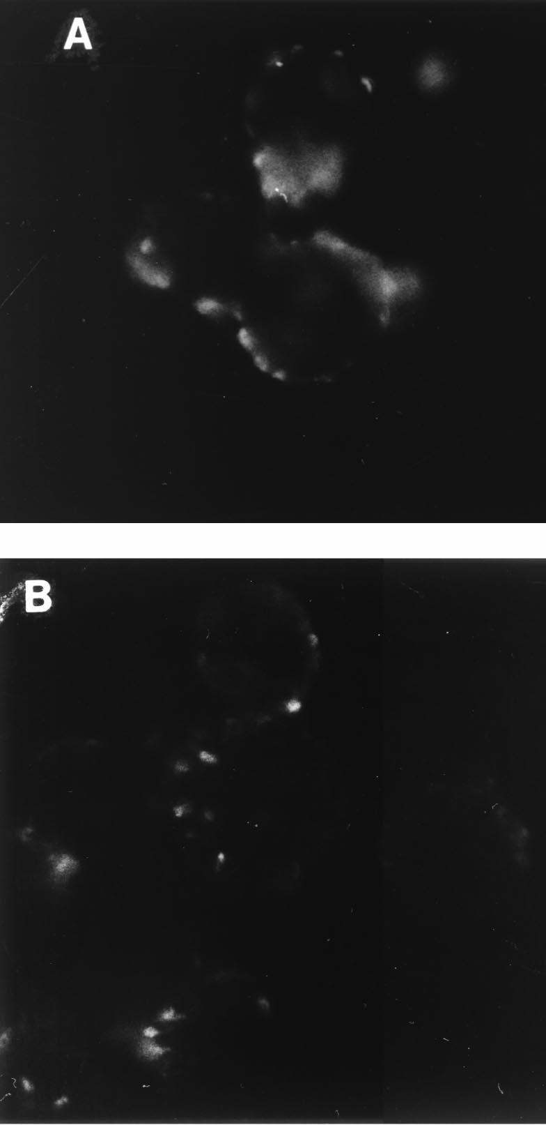 Adherence of the bacteria to Kato III cells revealed that strain F1 flaa::km showed a decrease in adherence at the lower bacterium/cell ratio (P 0.05) (Fig. 3).