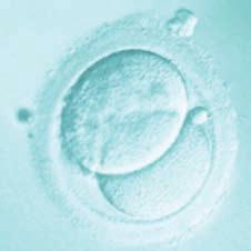 ICSI has similar success rates compared with conventional IVF.