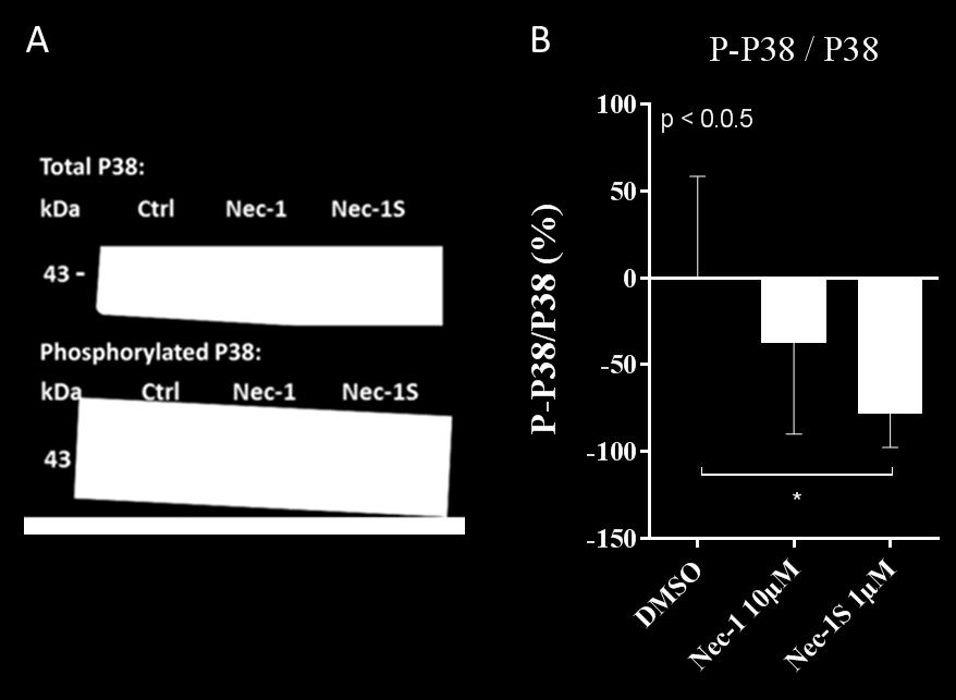 3.3.2 MAPK- and RISK pathway phosphorylation in necrostatin treated Langendorff-perfused hearts Protein extracts from all three groups of Langendorff-perfused hearts in series 2 were tested for