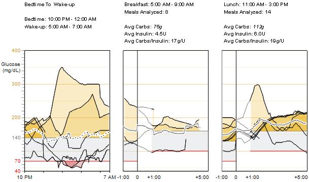 24-Hour Glucose Sensor Overlay Readings and Averages This graph combines the sensor glucose traces from each day on which a glucose sensor was worn.