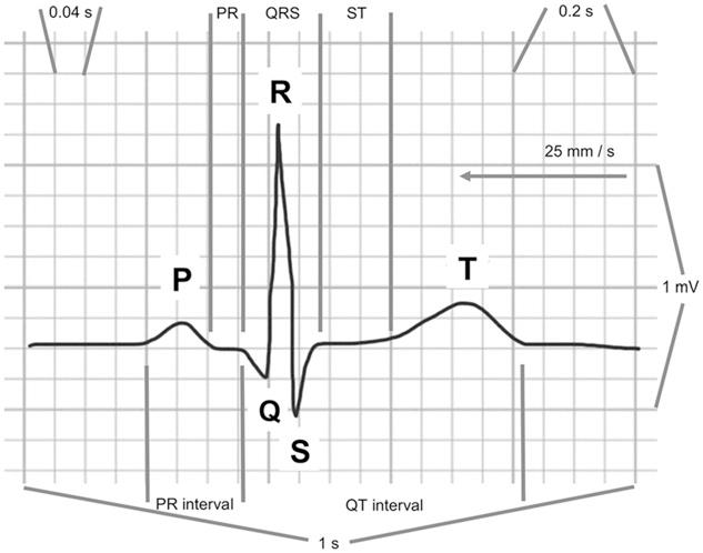 Atrial ectopic beats are associated with premature atrial contraction and manifest quite differently from premature ventricular contraction.