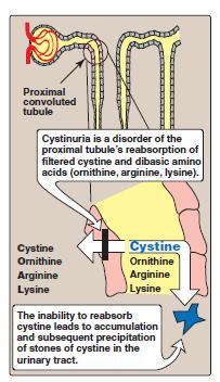 Clinical Hint: Cystinuria Inherited disorder The most common genetic error of amino acid transport.