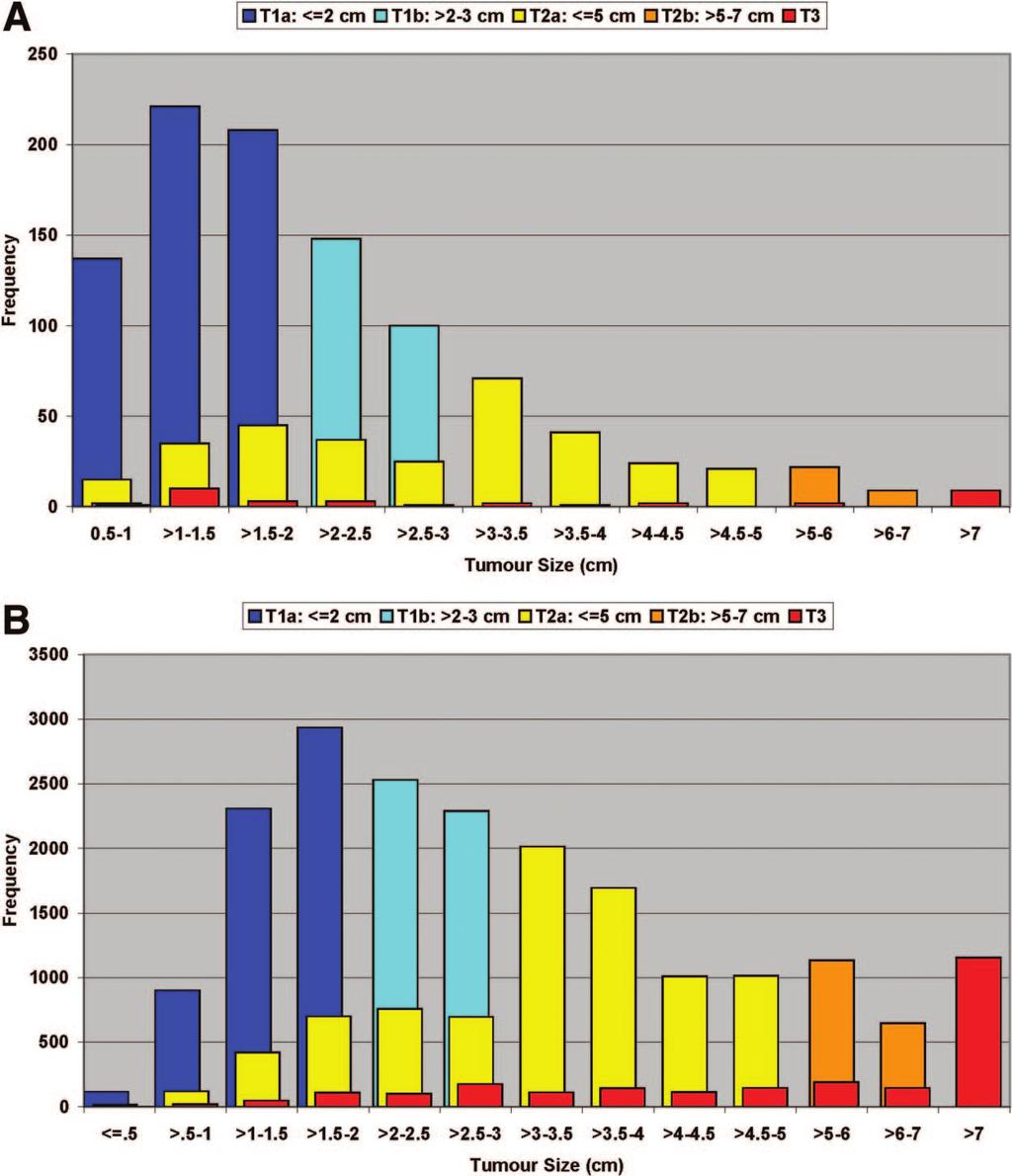 Journal of Thoracic Oncology Volume 3, Number 11, November 2008 TNM Classification in Pulmonary Carcinoid Tumors FIGURE 1. Histograms of tumor size, SEER surgically treated cases diagnosed 1990 2002.