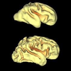 Human Cortical Development: Insights from Imaging David C.