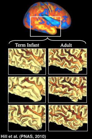 Postnatal cortical expansion: large regional differences 3-fold overall postnatal expansion Adult/neonatal surface area ratio High-expansion: frontal,