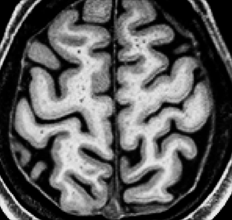 Myelin maps in cerebral cortex