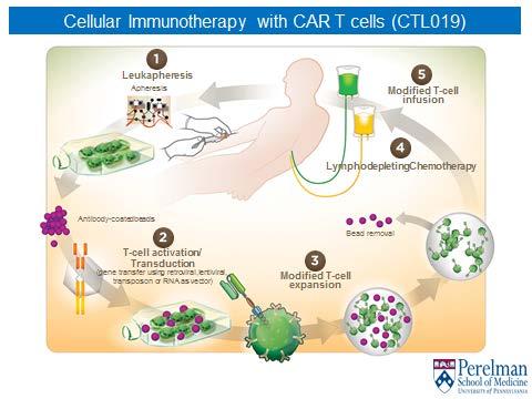 ELIANA: FIRST GLOBAL MULTI-CENTER CAR T CELL TRIAL IN PEDIATRIC ALL 94% of pts received CTL019 25 centers across 11