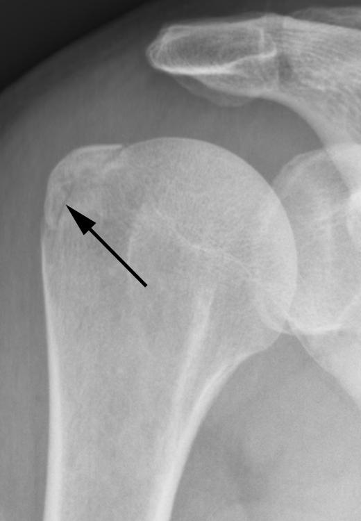 Imaging should be tailored to the joint.