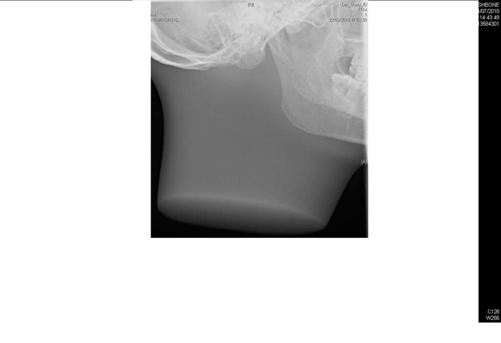 All twelve radiographs containing fish-bones were visible and indicated as such by the 15 Radiology Consultant and Registrars.