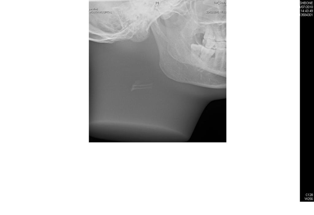 Fig. 4: Digital radiography of fish bones in a