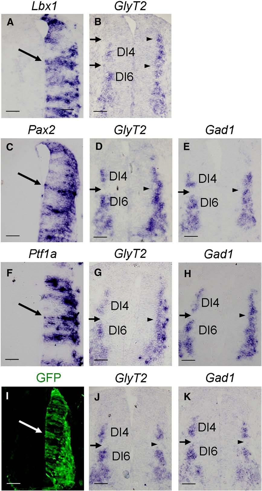 398 M. Huang et al. / Developmental Biology 322 (2008) 394 405 Fig. 2. Overexpression of Lbx1, Pax2 or Ptf1a in the chick neural tube promotes ectopic glycinergic and GABAergic differentiation.