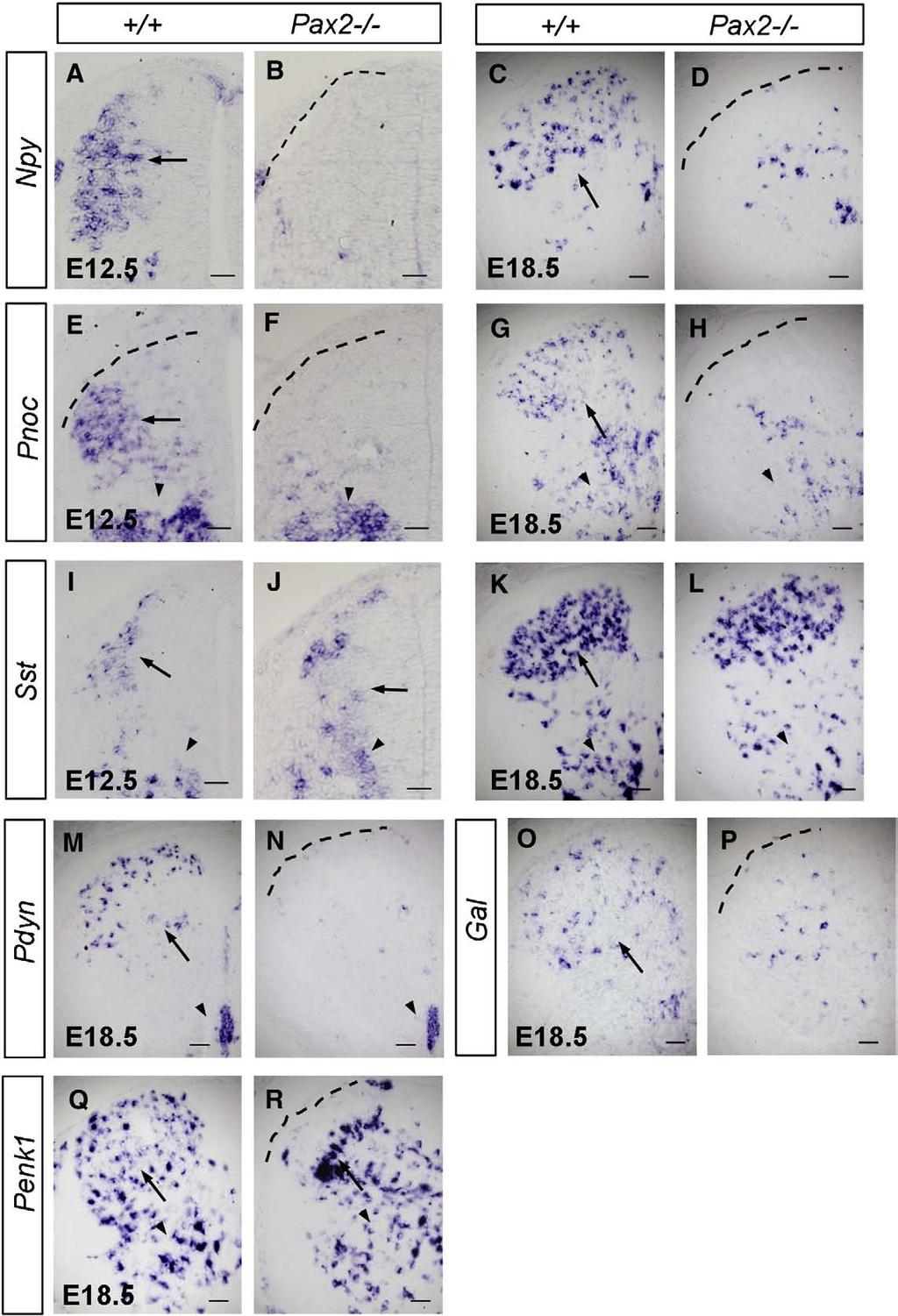 402 M. Huang et al. / Developmental Biology 322 (2008) 394 405 Fig. 6. Peptide gene expression in Pax2 / mice.